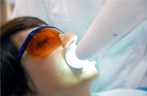 Understanding the Causes of Teeth Sensitivity Slough