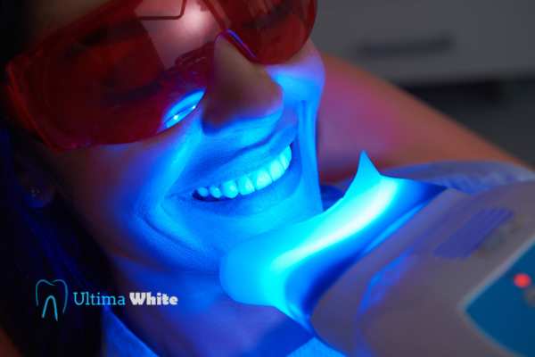 Professional Teeth Whitening Options Slough
