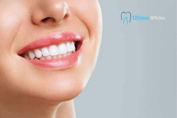 Common Mistakes That Can Ruin Your Whitening Results Slough