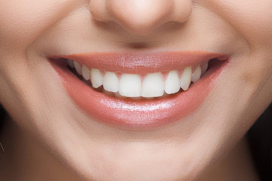 Beyond Whitening: How Your Daily Diet Affects Long-Term Smile Brightness Slough