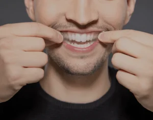 Overview of Home Teeth Whitening Kits Slough