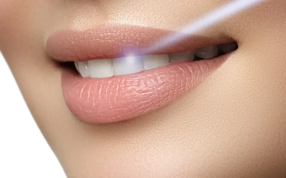Key Insights for a Radiant Smile {name} The Whitening Treatments