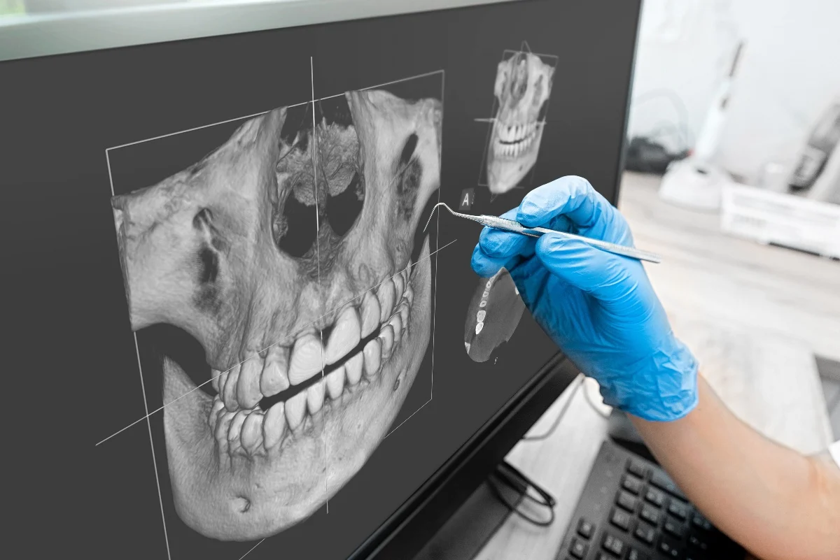How Is AI Transforming Dental Treatment Planning Slough?