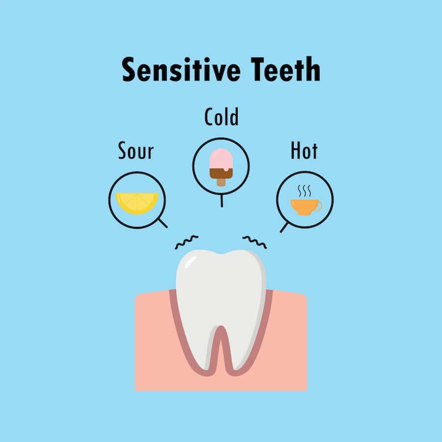 How Can You Tell If Your Teeth Are Becoming Sensitive Slough?