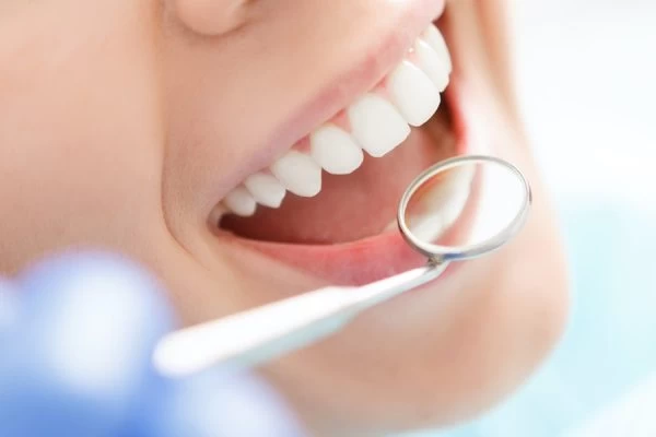How to Maintain Your Whiter Smile After Treatment Slough