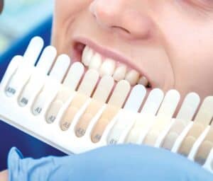 Ultimate Guide to Teeth Whitening with Natural Ingredients Slough