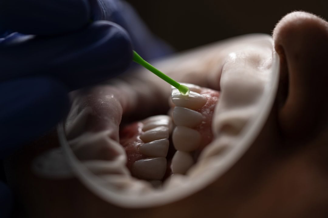 How Saliva Protects Your Teeth and Gums Slough
