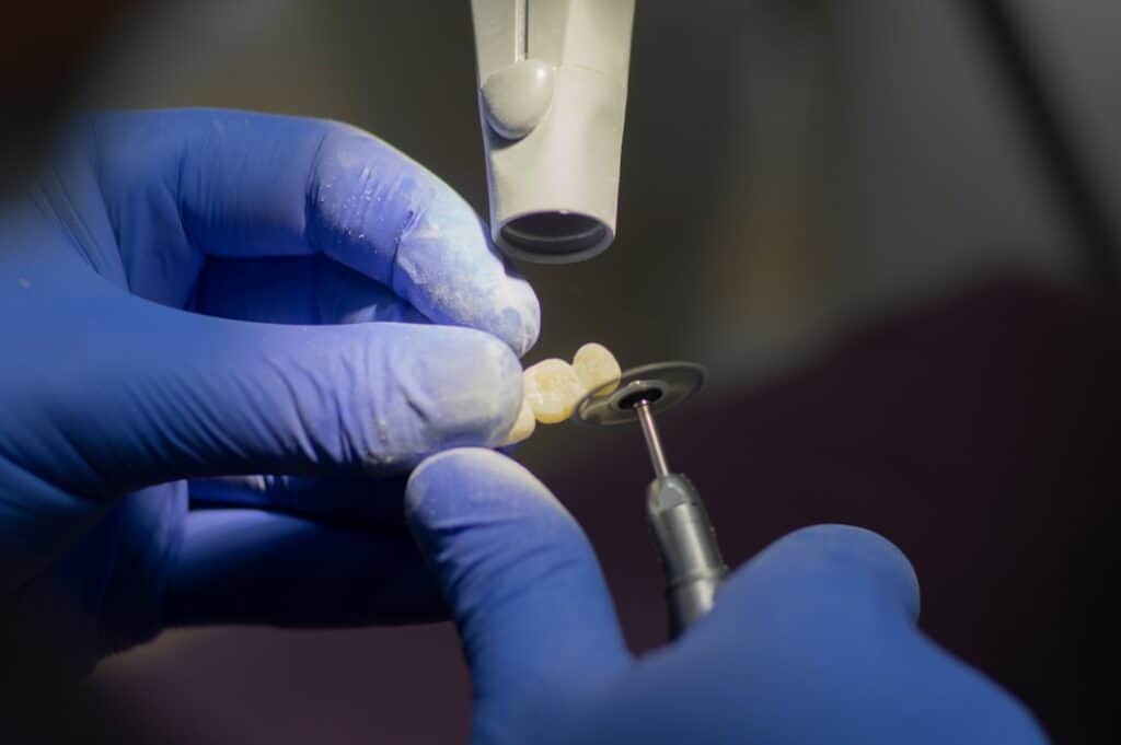 Customised Dental Solutions: Crowns, Aligners, and Implants Slough