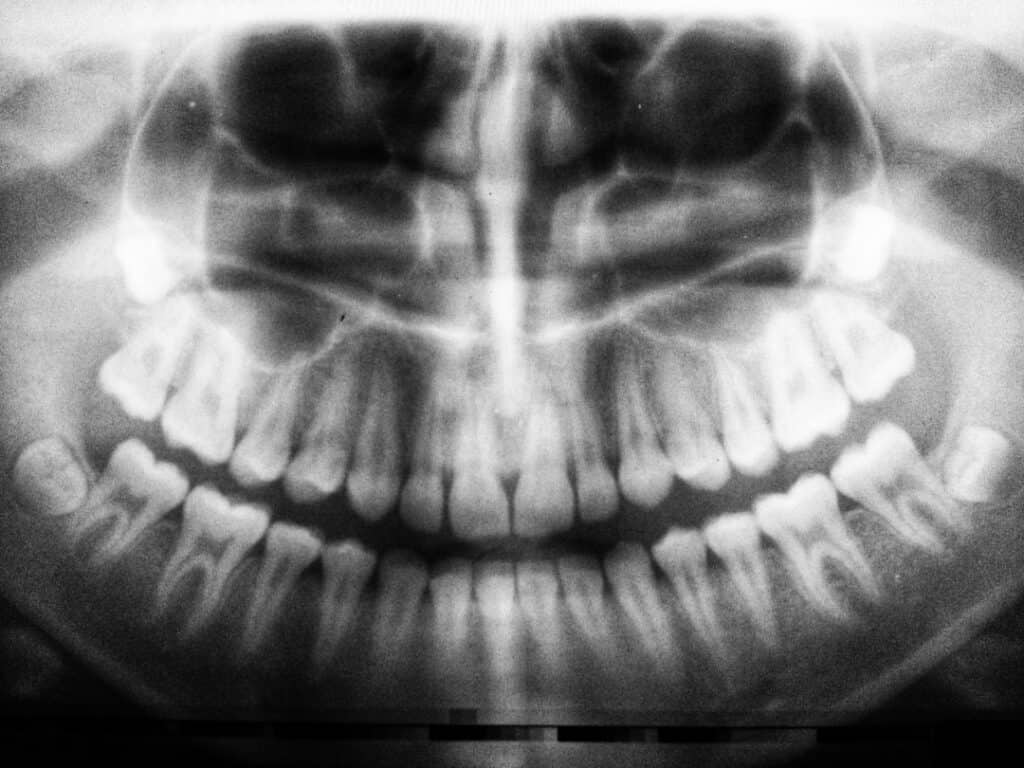 The Future of 3D Printing in Oral Healthcare Slough