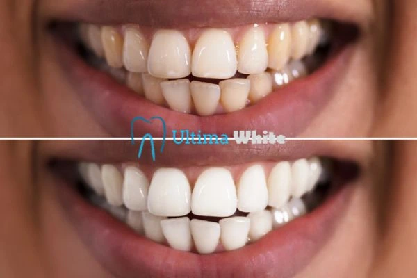 Long lasting results from Ultima White Slough